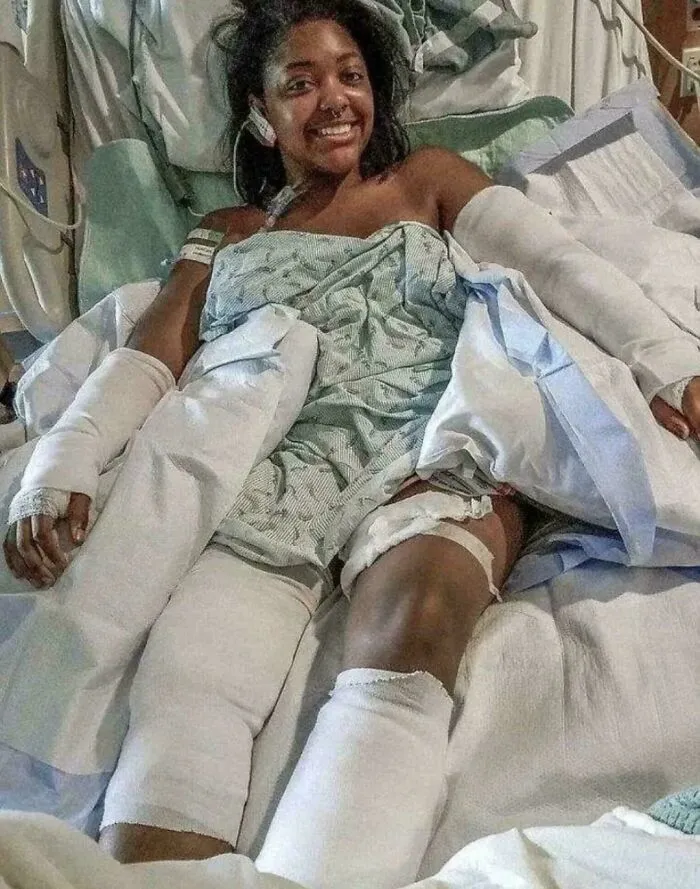 She Took 40 Bites To Save A Baby’s Life