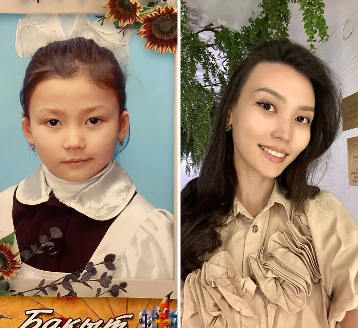 Ugly-Duckling-Before-After