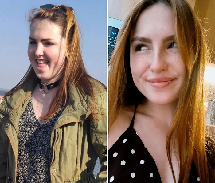 48 “Ugly Ducklings” Share The Incredible Transformations That Made Them Love Themselves