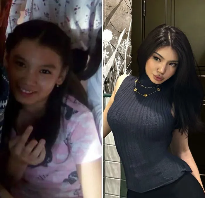 Ugly-Duckling-Before-After