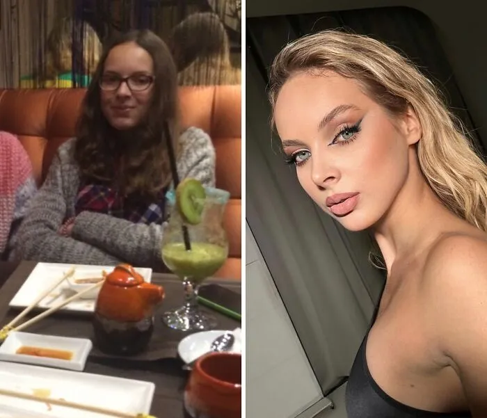 Ugly-Duckling-Before-After