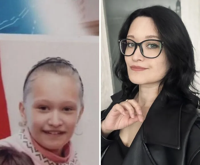 48 “Ugly Ducklings” Share The Incredible Transformations That Made Them Love Themselves