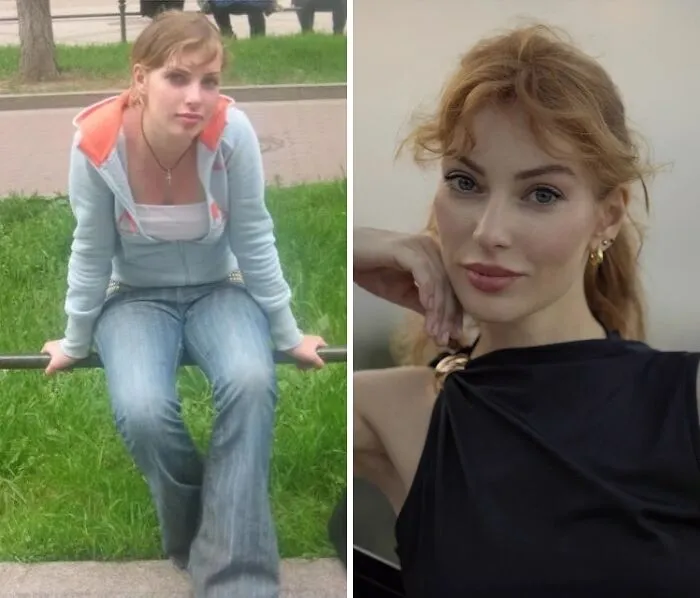48 “Ugly Ducklings” Share The Incredible Transformations That Made Them Love Themselves