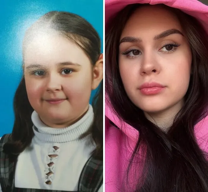 48 “Ugly Ducklings” Share The Incredible Transformations That Made Them Love Themselves