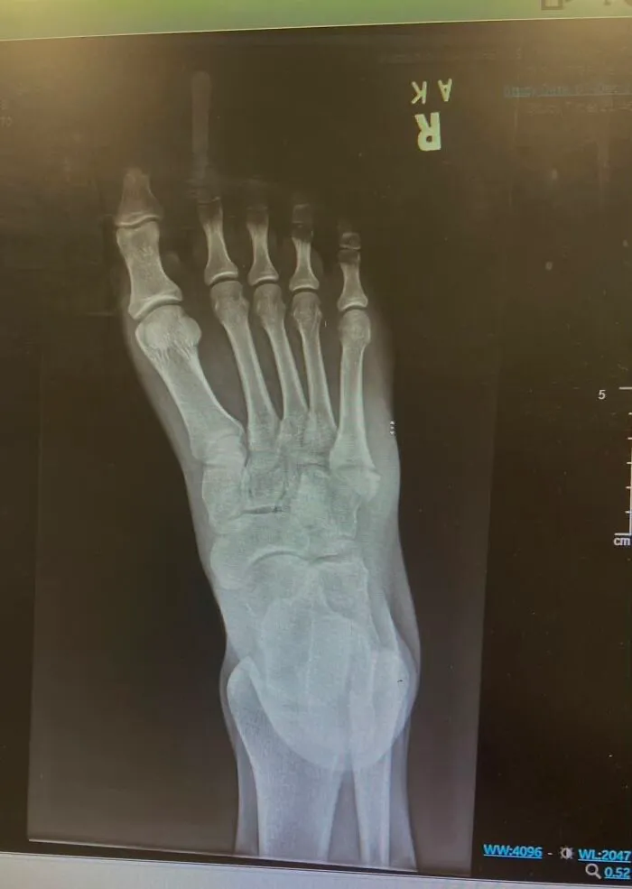 56 ER Patients Share The Mistakes That Sent Them To The Hospital