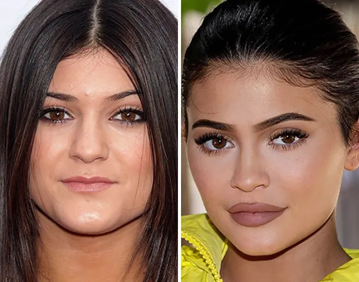 Kylie Jenner
