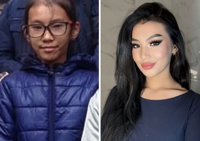 48 “Ugly Ducklings” Share The Incredible Transformations That Made Them Love Themselves