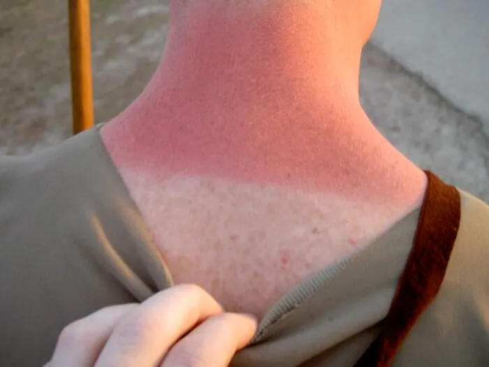 49 Things People Said Really Hurt Them Despite Their High Pain Tolerance
