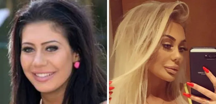 Chloe Ferry (Geordie Shore)