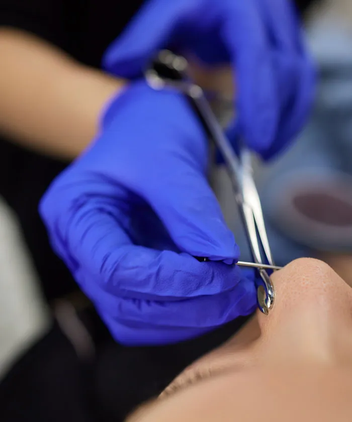 Gloved hands holding tool near nose during body-related procedure