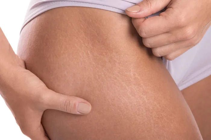 56 Women Share The Comments They Received About Their Bodies That They Didn't See Coming