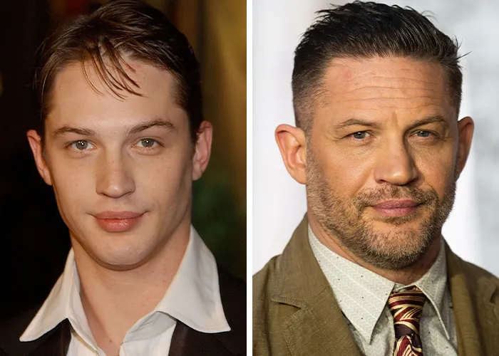 Tom Hardy
