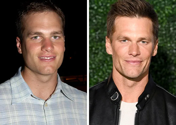 Tom Brady