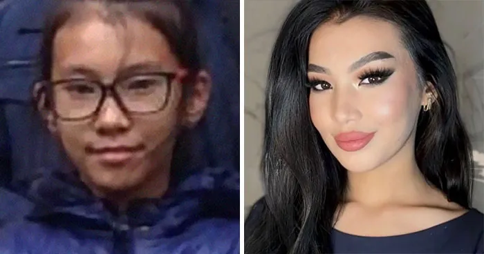 48 “Ugly Ducklings” Share The Incredible Transformations That Made Them Love Themselves