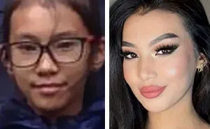 48 “Ugly Ducklings” Share The Incredible Transformations That Made Them Love Themselves