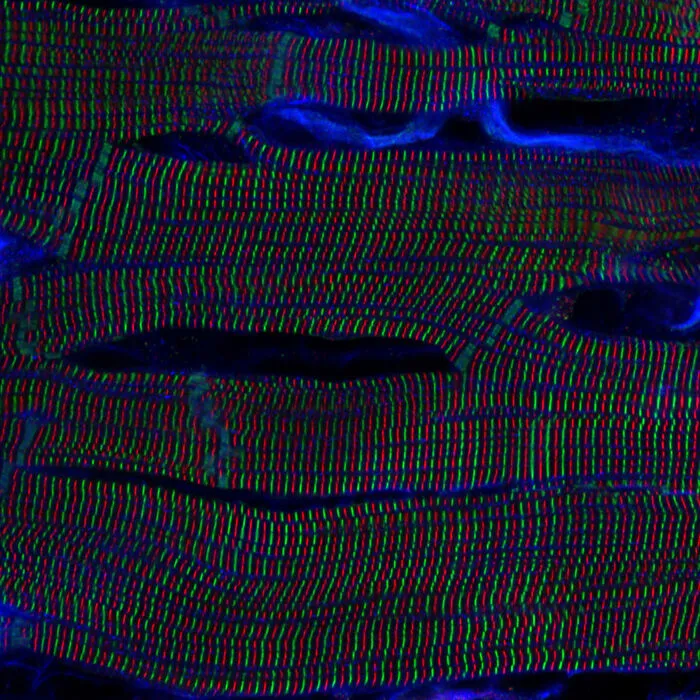 “Sarcomere Structures Within Cardiomyocytes In A Rat Heart” By Kentauro Mochizuki