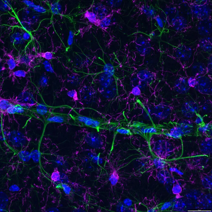 “Fluorescent Immunostained Brain Tissue From An Alzheimer’s Disease Mouse Model” By Bettina Rákóczi