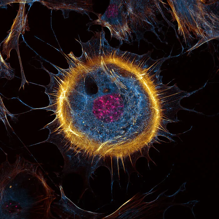 “Mouse Embryonic Fibroblast” By Joe Mckellar