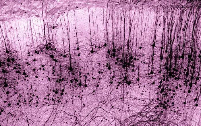 “Gfp-Positive Thy1 Neuron In A Tissue-Cleared Mouse Brain” By Marko Pende