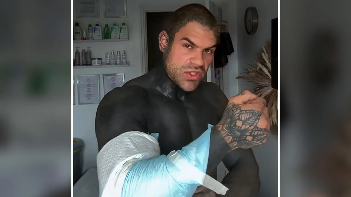 Man Covered In Blackout Tattoos Reveals Harsh Truths He Wishes He’d Known Before Diving Into The Trend