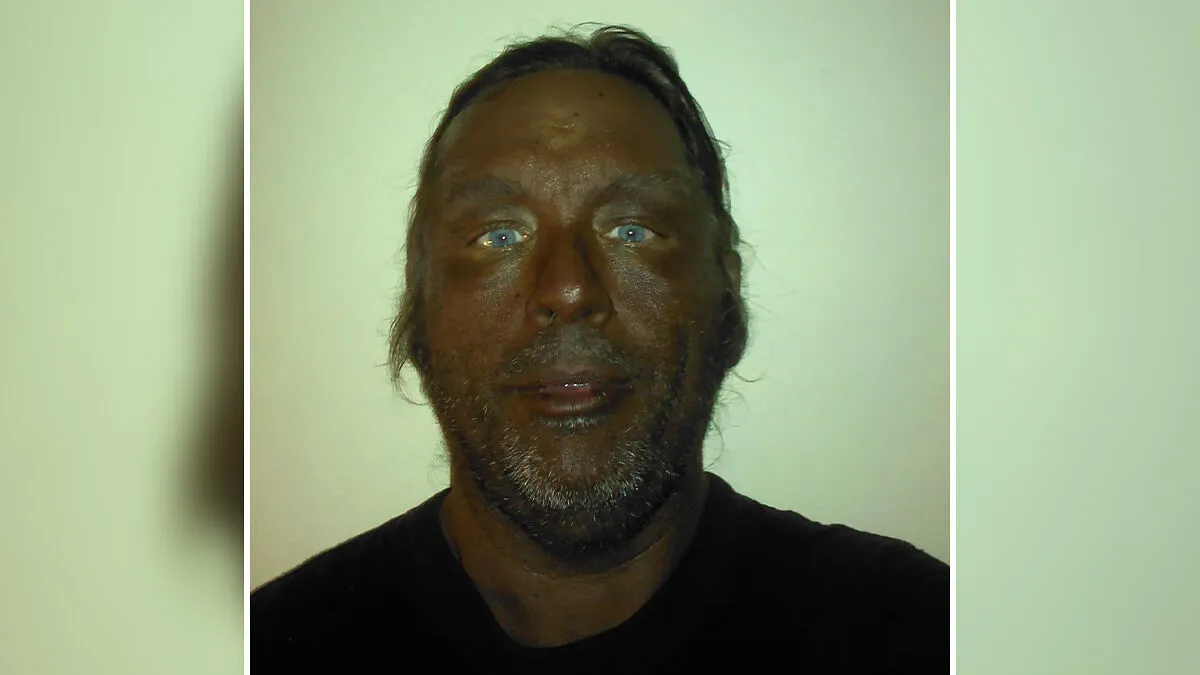 "Breaking New Ground": Man Reveals Results After Injecting Himself With Unregulated Tanning Peptide Melanotan 2