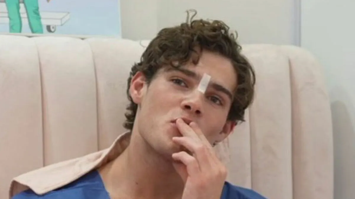 "Looksmaxxing" Influencer Clavicular Shares Nose Job, But All Fans Notice Is His Post-Hormone Transformation