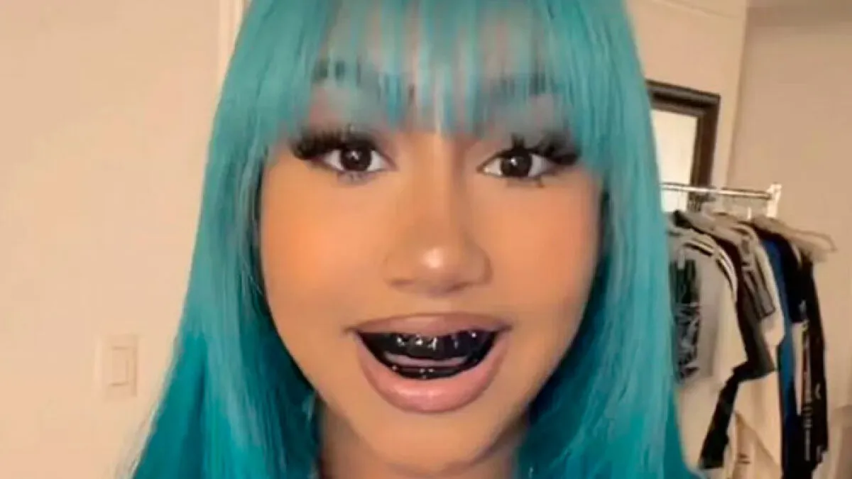 After North West Debuts 'Blackened Teeth,' Experts Reveal What Many People Don't Know About Black Grills