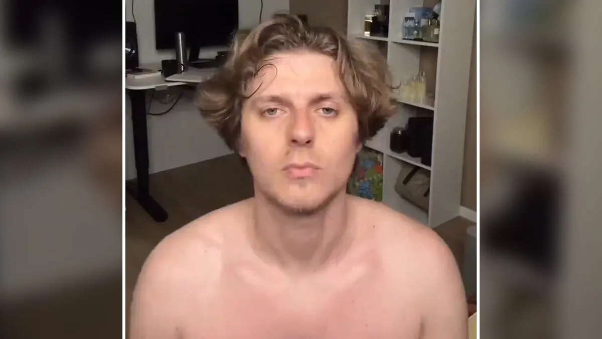 Man Reveals Dramatic 80-Day Transformation After Daily Jaw Exercises