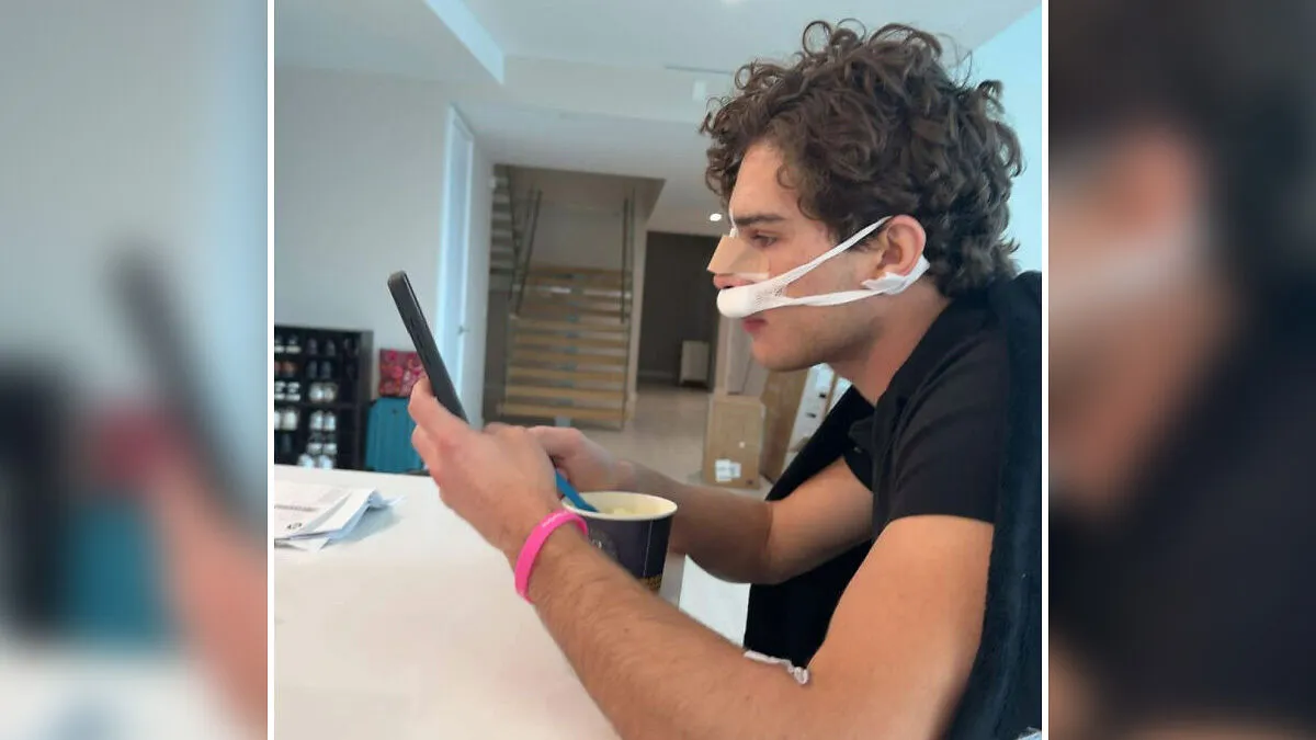 Looksmaxxer Clavicular Shows Off His Nose Job Before-And-After, And Fans Are Worried He "Ruined His Face"