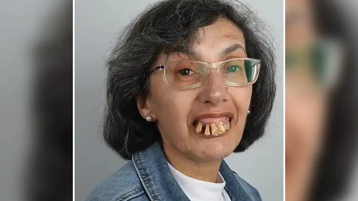 10 Jaw-Dropping Before-And-After Collages Of Women Who Underwent Extensive Smile Makeovers