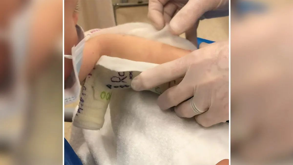 Doctor Discovers Jaw‑Dropping Surprise Hidden In Four‑Year‑Old Boy’s Plaster Cast