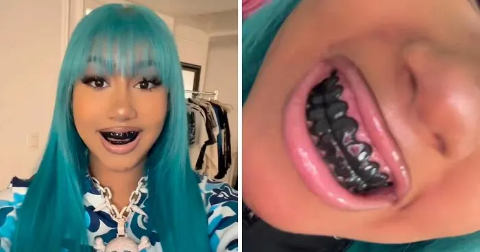 After North West Debuts 'Blackened Teeth,' Experts Reveal What Many People Don't Know About Black Grills