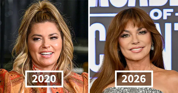 After Trying To Conform To Beauty Standards, Shania Twain Reveals Terrifying Side Effects Of Her Transformation