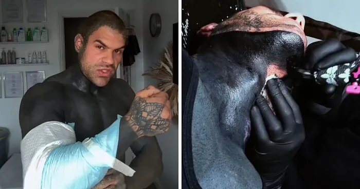 Man Covered In Blackout Tattoos Reveals Harsh Truths He Wishes He’d Known Before Diving Into The Trend