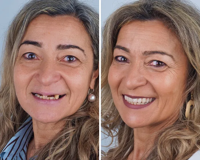 Natércia