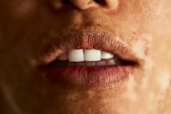 “Farts Of Bacteria”: 37 Human Body Facts That Make Existing Feel A Little More Uncomfortable 
