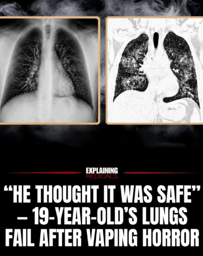 “A Lifetime Of Consequences”: 61 Cool And Interesting Medical Facts