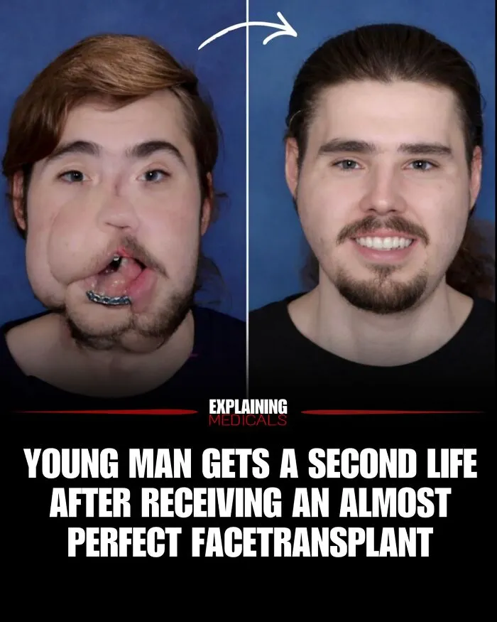 “A Lifetime Of Consequences”: 61 Cool And Interesting Medical Facts