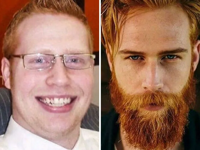 Antes y ahora