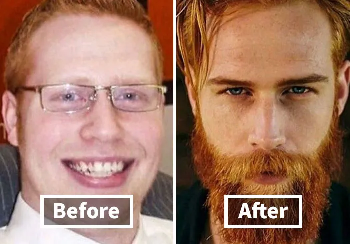“My Bullies Are Shook”: 65 People Who Completely Reinvented Their Looks And Never Looked Back