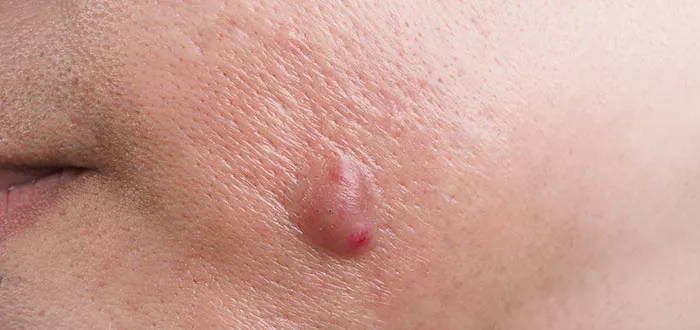 “Doctors, What Symptoms Do People Often Ignore That They Shouldn’t?” (66 Answers)