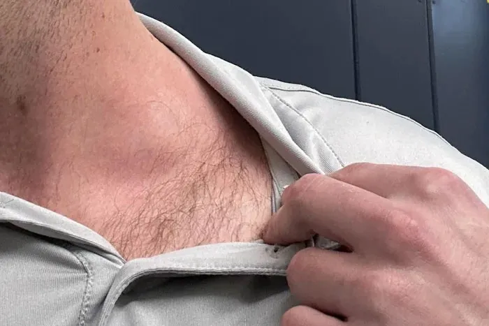 “Doctors, What Symptoms Do People Often Ignore That They Shouldn’t?” (66 Answers)