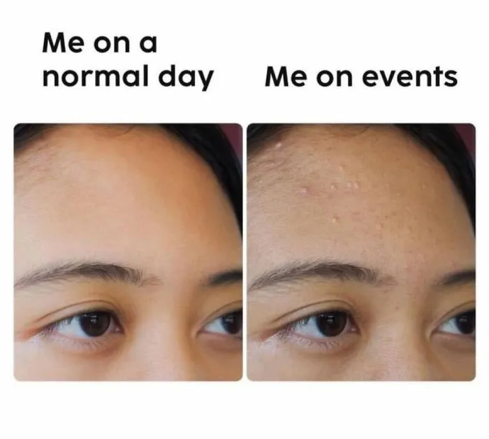 Funny posts about being a woman: A split image showing a woman's forehead, clear on a normal day vs. breakouts for events.