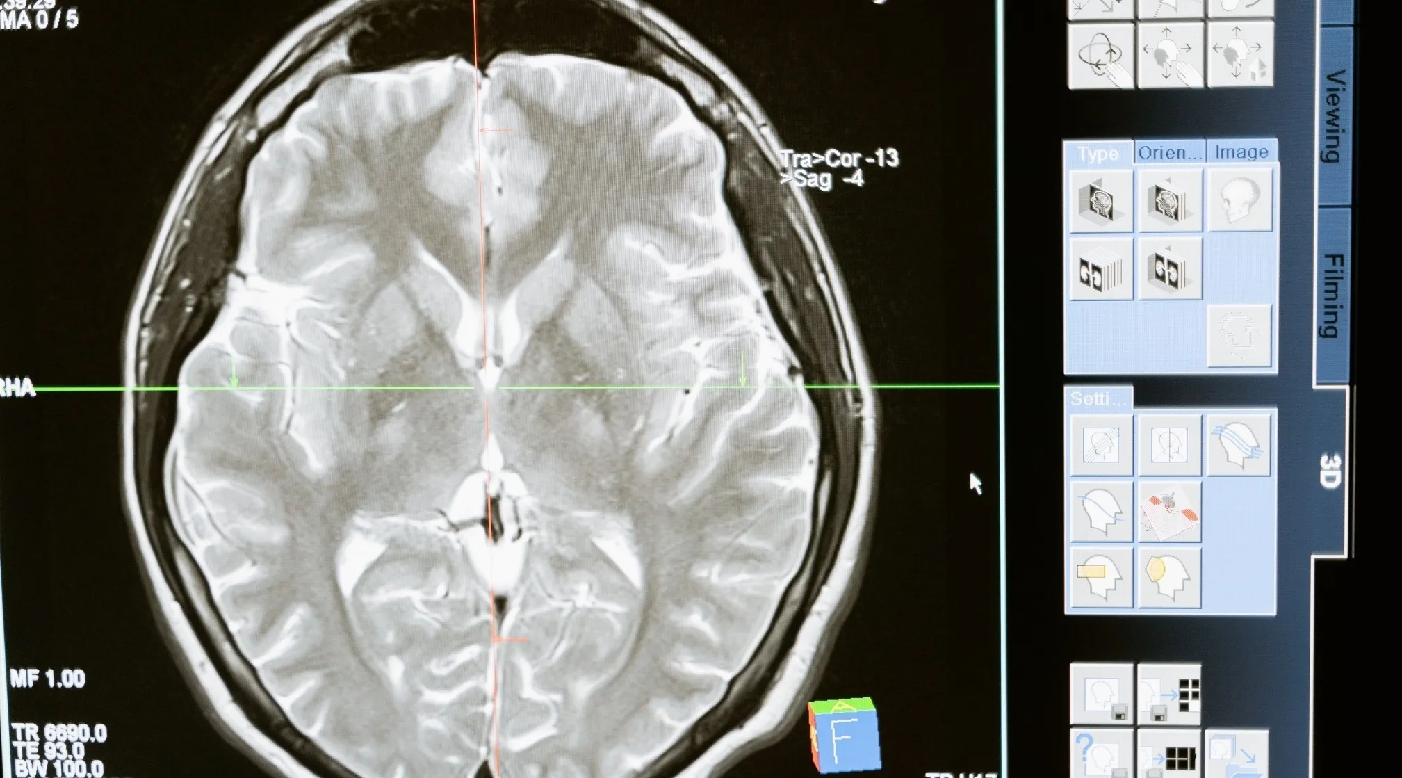 Brain scan with a red and green crosshair. This image relates to human body and memory formation.