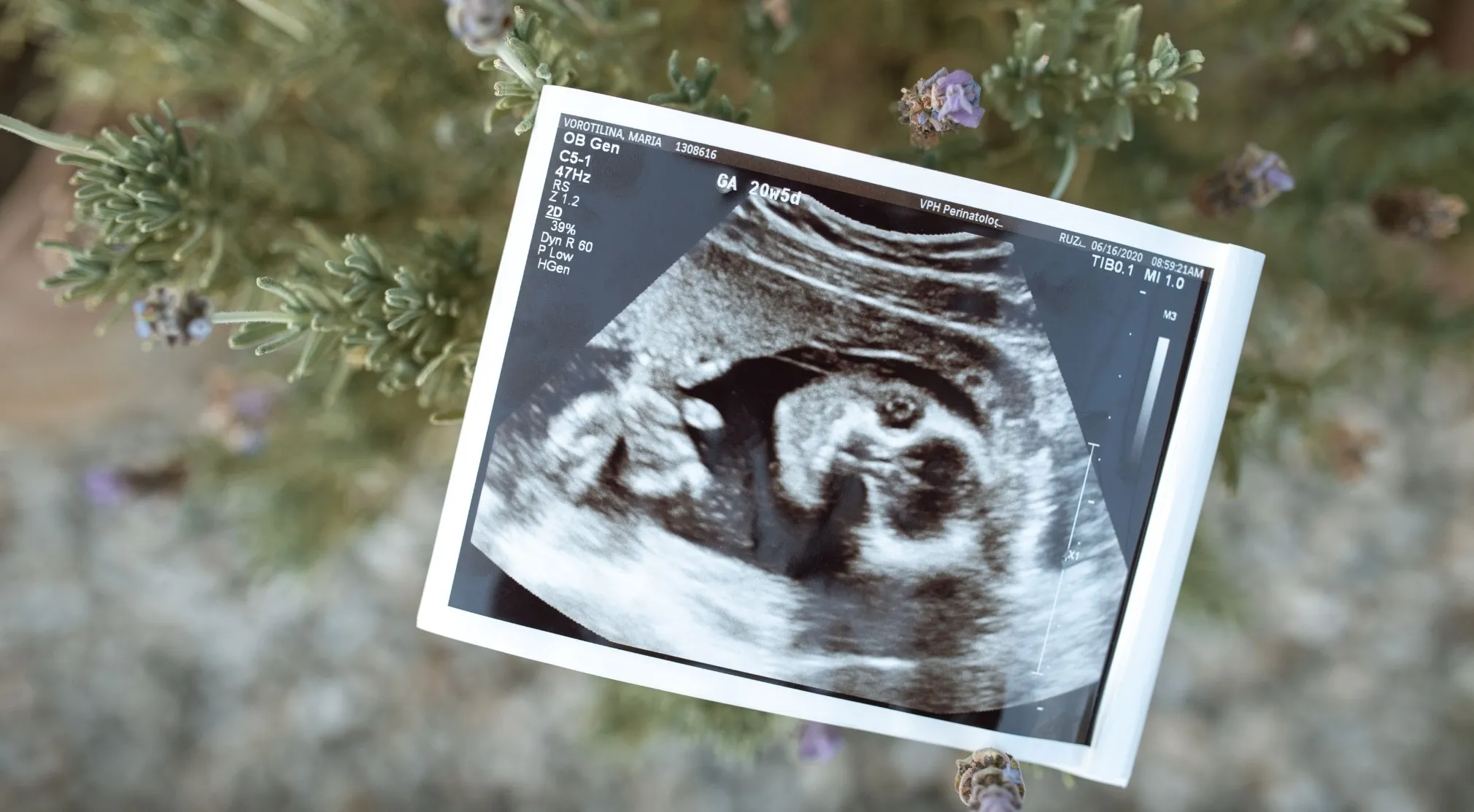 An ultrasound scan displaying a developing baby, emphasizing the human body and pregnancy, amidst a lavender plant background.