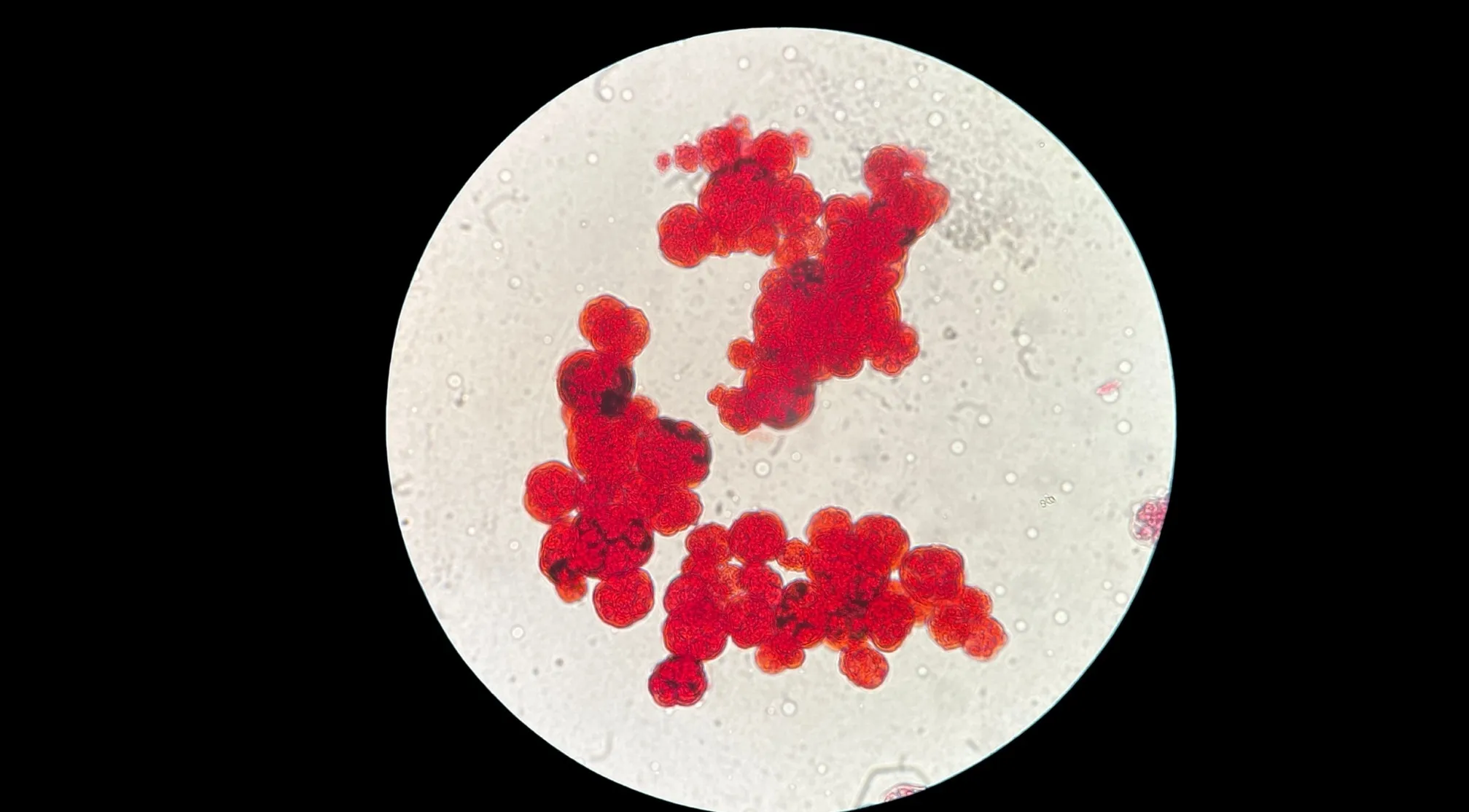 Microscopic view of red blood cells, appearing as clusters of red spheres on a light background, related to human body.