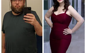 90 Of The Most Interesting “Before And After” Photos Of How People Changed