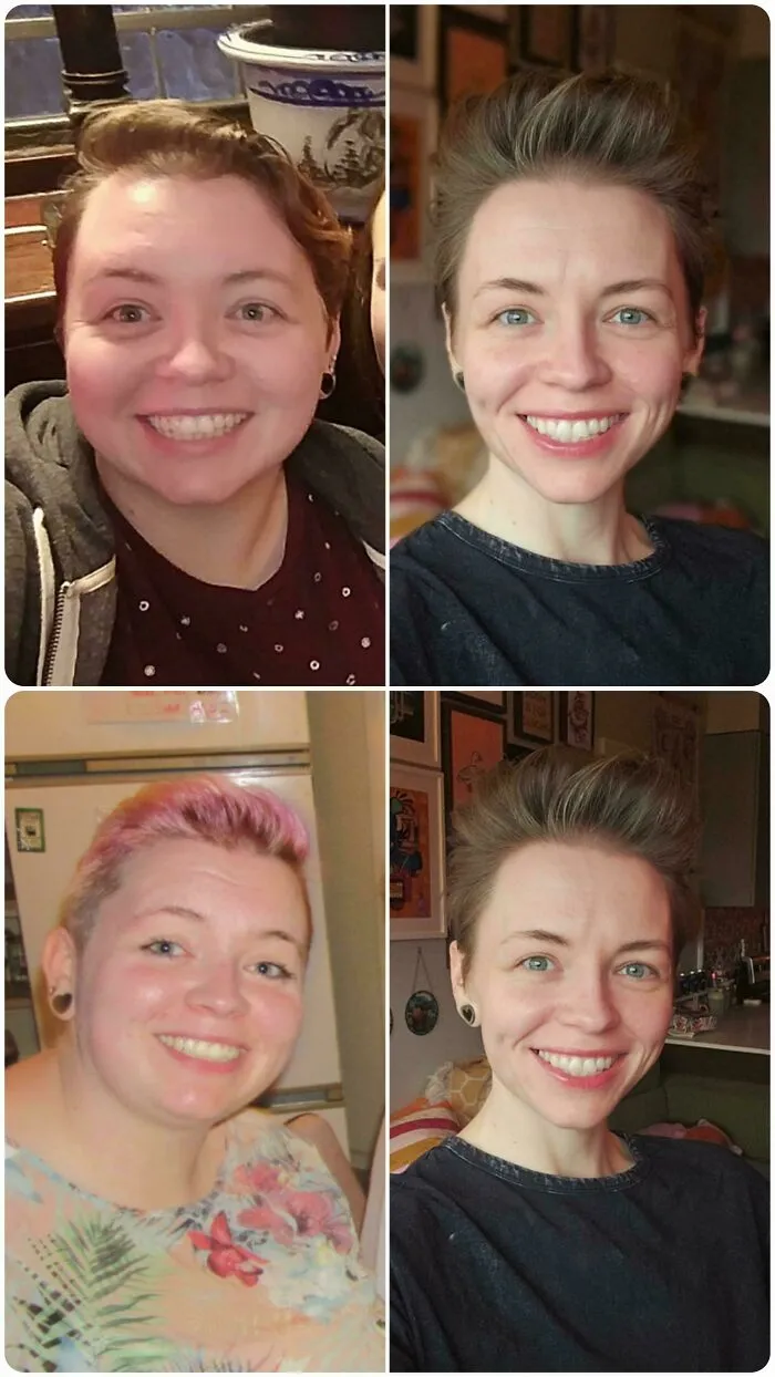 F/35/5'6" [320 > 150 = 170lbs] 10 Year Face Gains!