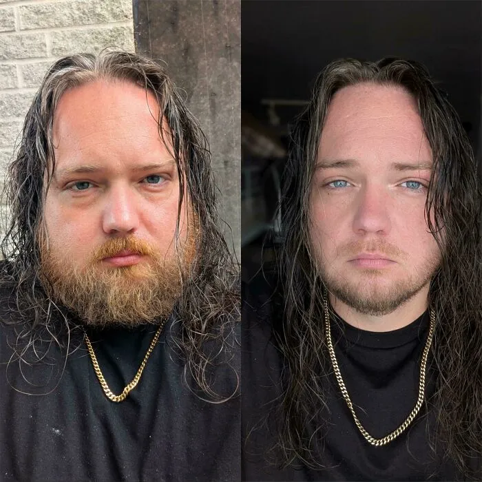 37 años, en 6 meses he perdido 39 kilos y se me nota en la cara 