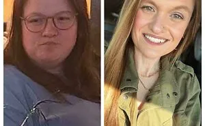 90 Of The Most Interesting “Before And After” Photos Of How People Changed